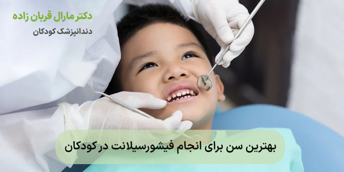 بهترین سن برای انجام فیشورسیلانت در کودکان