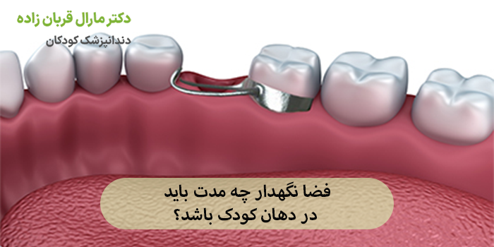 فضا نگهدار چه مدت باید در دهان کودک باشد؟