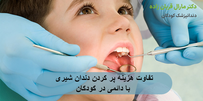 تفاوت هزینه پر کردن دندان شیری با دائمی در کودکان