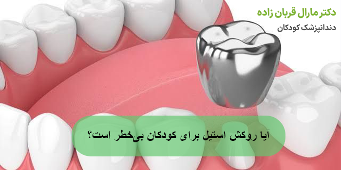 آیا روکش استیل برای کودکان بیخطر است؟