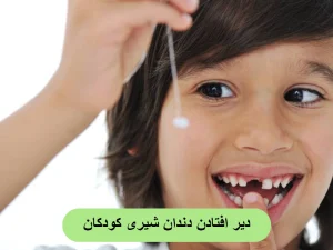 دیر افتادن دندان شیری کودکان