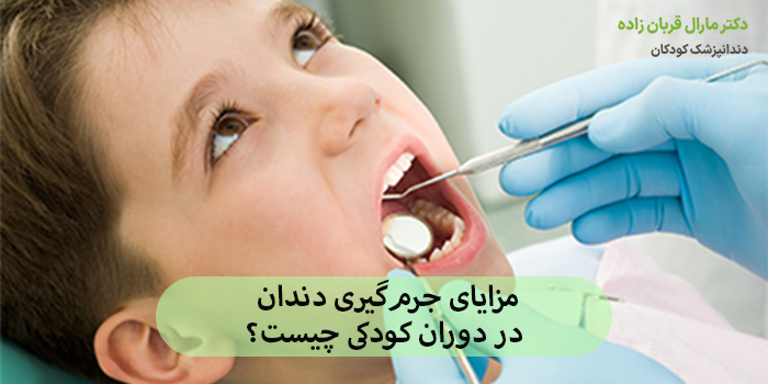 مزایای جرمگیری دندان در دوران کودکی چیست؟
