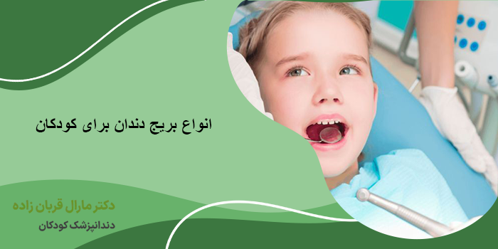 انواع بریج دندان برای کودکان