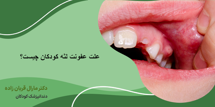 علت عفونت لثه کودکان چیست؟