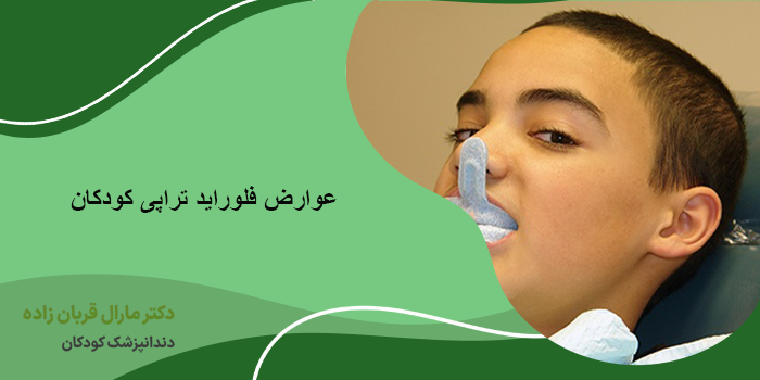 عوارض فلوراید تراپی کودکان