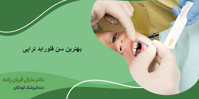 بهترین سن فلوراید تراپی
