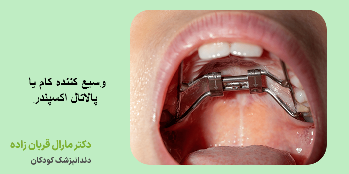 وسیع کننده کام