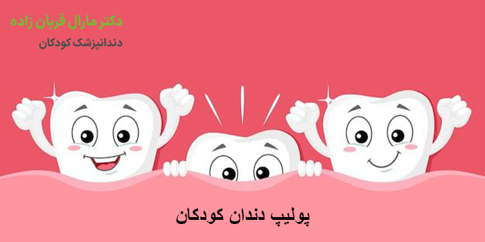 پولیپ دندان کودکان
