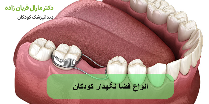 انواع فضا نگهدار کودکان
