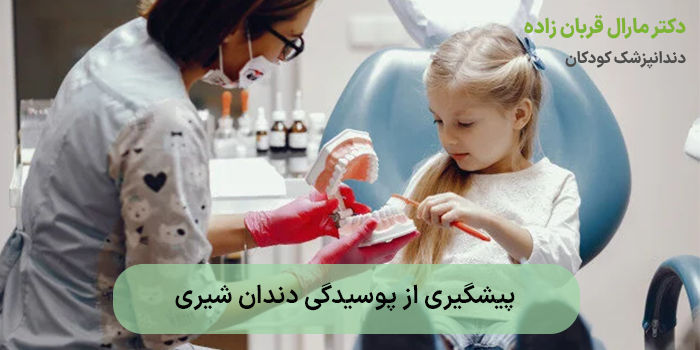 پیشگیری از پوسیدگی دندان شیری