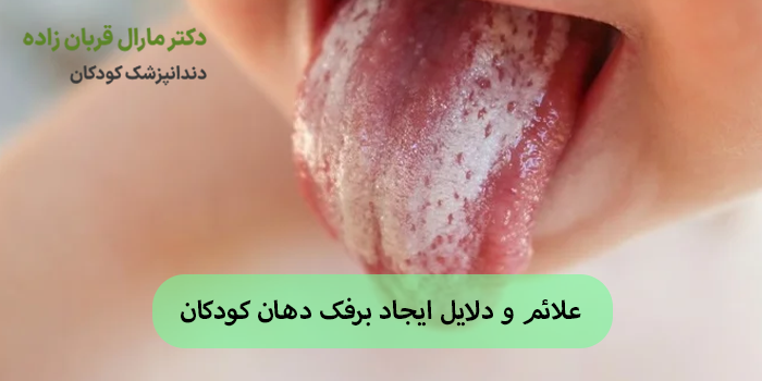 برفک دهان نوزادان