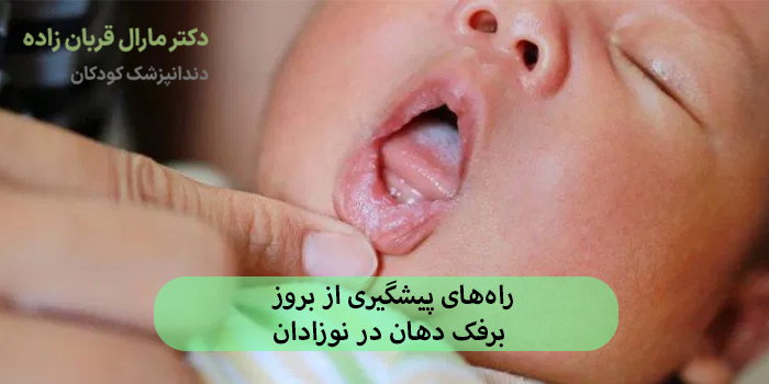 راههای پیشگیری از بروز برفک دهان در نوزادان
