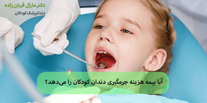 آیا بیمه هزینه جرمگیری دندان کودکان را میدهد؟