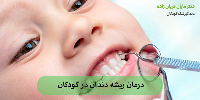 درمان ریشه دندان در کودکان