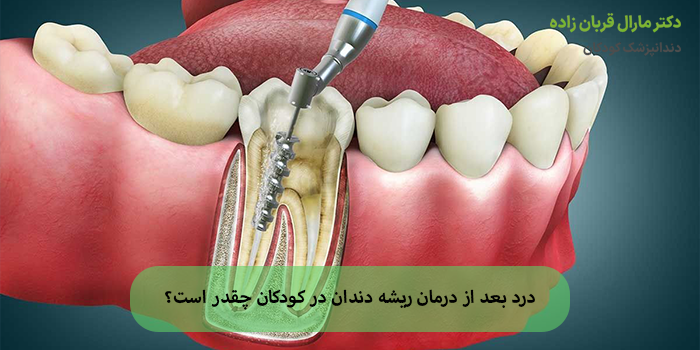 درد بعد از درمان ریشه دندان در کودکان چقدر است؟