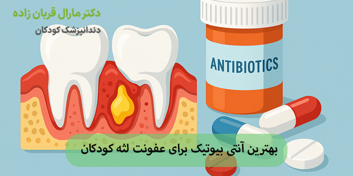 بهترین آنتی بیوتیک برای عفونت لثه کودکان