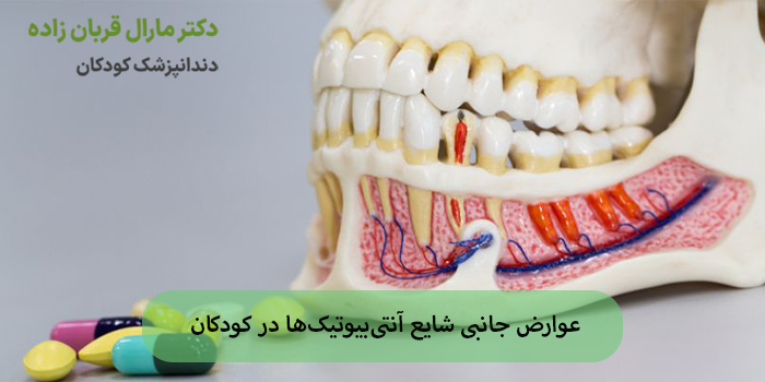عوارض جانبی شایع آنتیبیوتیکها در کودکان