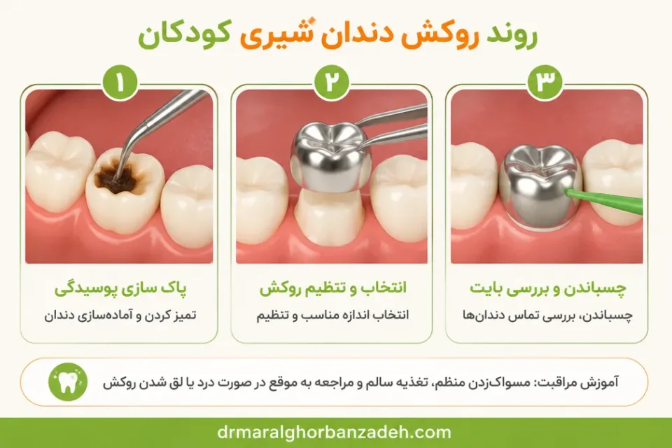 نمای توضیحی درباره چسباندن، بررسی تماس دندانها و آموزش مراقبت